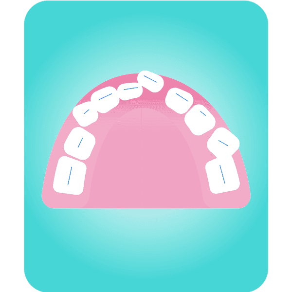 Illustration av obalanserade tänder
