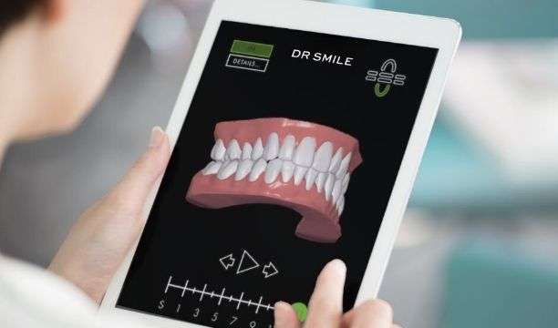 Tandläkare undersöker en 3D-simulering av en tand före och efter DR SMILE-behandling