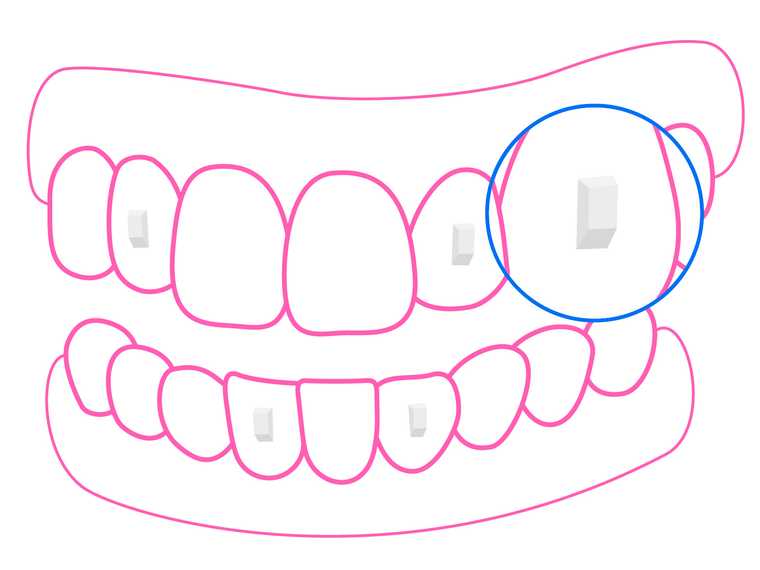 Engagers Attachment Illustration