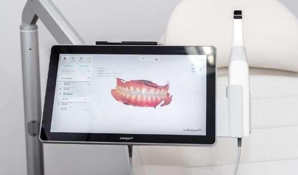 Foto av en 3D-skanner och dess 3D-simulering av en käke efter en undersökning DR SMILE